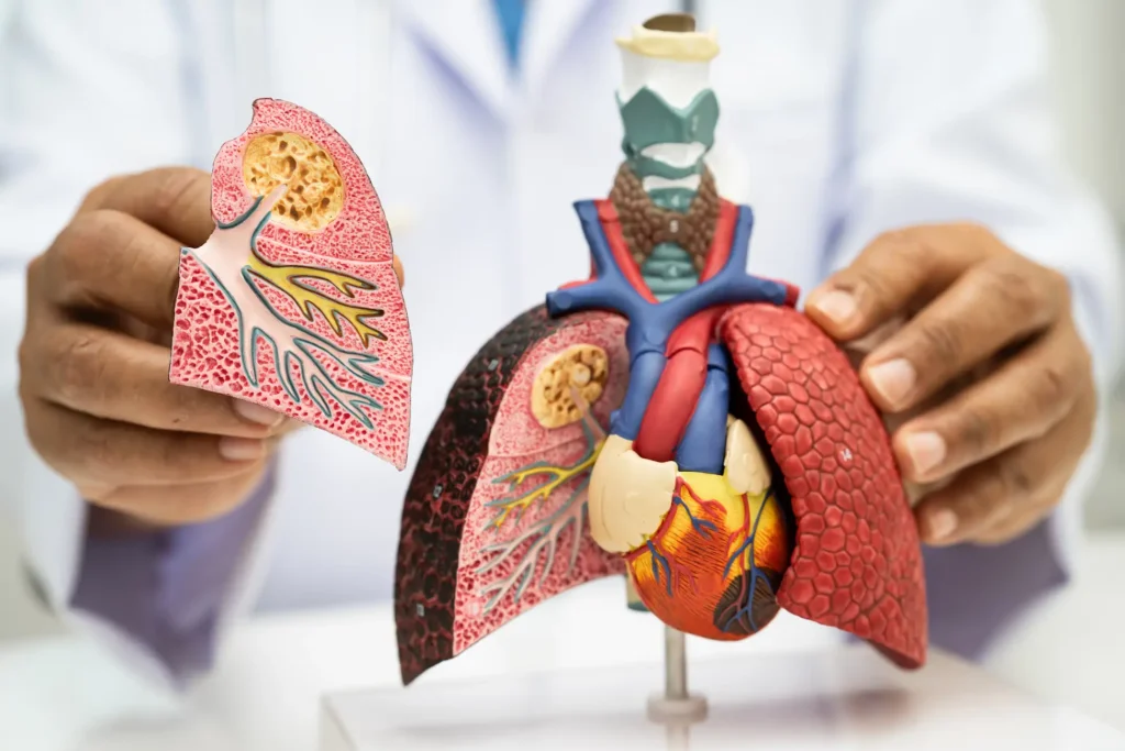 cirugia cardiotoracica hospital del holding