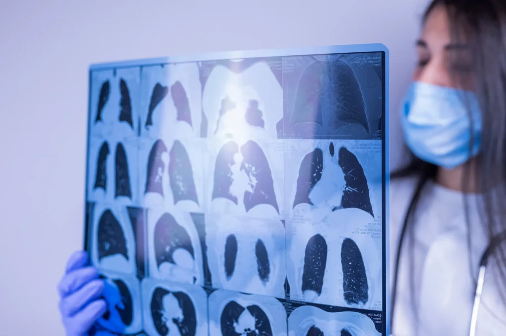 departamento de neumologia hospital del holding